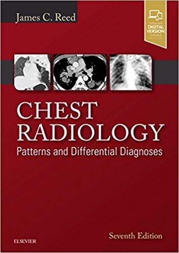 CHEST RADIOLOGY Patterns and Differential Diagnoses 2018 - رادیولوژی